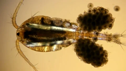 Copepoda under the microscope Stock Footage 106735149