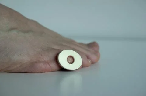 A corn plaster on the little toe of a foot, isolated on white background. Stock Photos