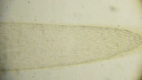 Corn root through microscope, magnified 40 times Stock Footage 93818106
