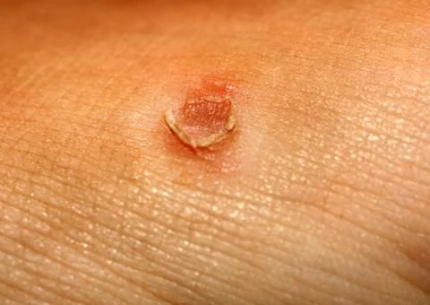 Corn on the skin. The corn popped. Stock Photos
