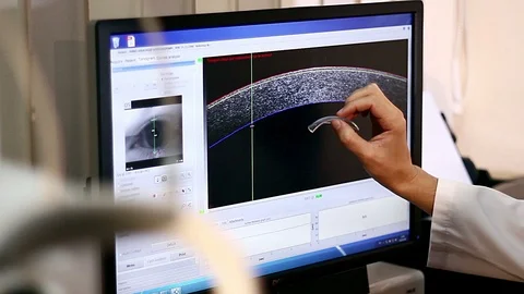Corneal wavefront analysis Stock Footage 100159924