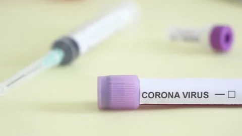 Corona screening test Stock Footage 148485307