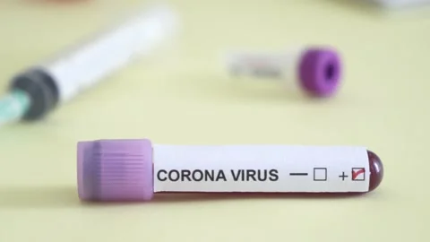 Corona screening test Stock Footage 148485337
