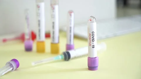 Corona screening test Stock Footage 148485352