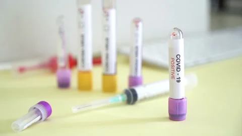 Corona screening test Stock Footage 148485405