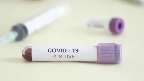 Corona screening test Stock Footage 148485430
