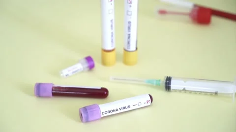 Corona screening test Stock Footage 148485760
