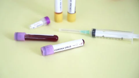 Corona screening test Stock Footage 148485824