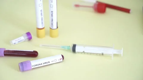 Corona screening test Stock Footage 148485924