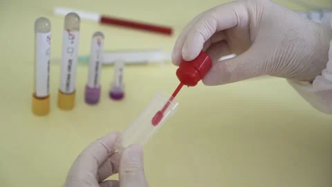Corona screening test Stock Footage 148486396