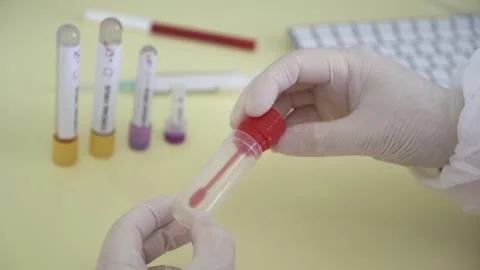 Corona screening test Stock Footage 148486648