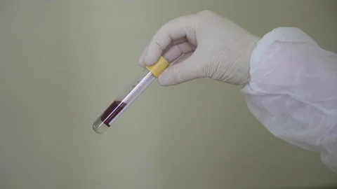 Corona screening test Stock Footage 148487616