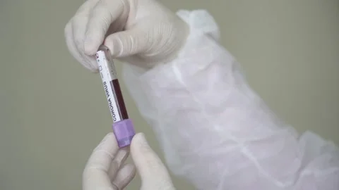 Corona screening test Stock Footage 148487629