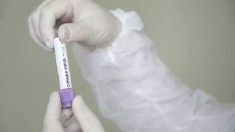 Corona screening test Stock Footage 148488011