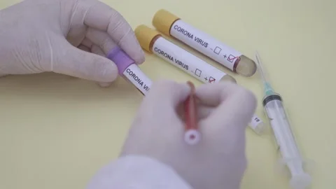 Corona screening test Stock Footage 148488512