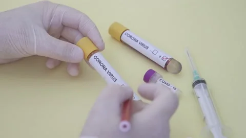Corona screening test Stock Footage 148488525