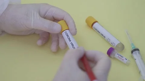 Corona screening test Stock Footage 148488636