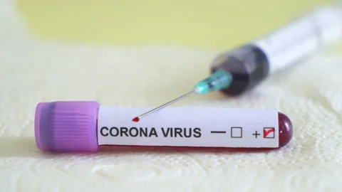 Corona screening test Stock Footage 148496261