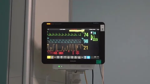 Corona therapy and ECG device screen in the hospital Stock Footage 148480314
