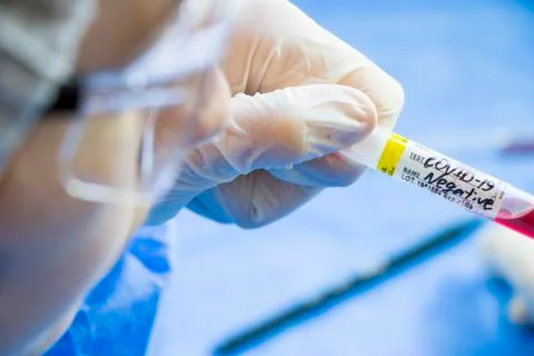 Corona virus negative test samples. Diagnosis and laboratory. Studio shoot, w Stock Photos