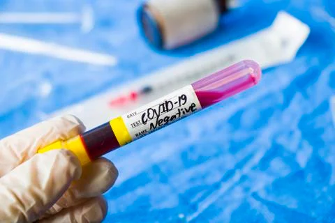 Corona virus negative test samples. Diagnosis and laboratory. Studio shoot, w Stock Photos