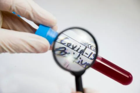 Corona virus positive test samples. Diagnosis and laboratory. Studio shoot, w Stock Photos