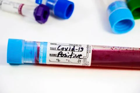 Corona virus positive test samples. Diagnosis and laboratory. Studio shoot, w Stock Photos
