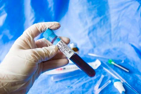 Corona virus positive test samples. Diagnosis and laboratory. Studio shoot, w Stock Photos