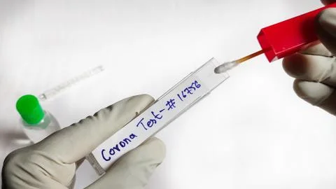 Corona Virus testing kit in hands on lab table Stock Photos
