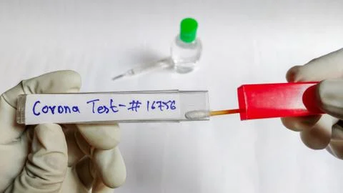 Corona Virus testing kit in hands on lab table Foto stock