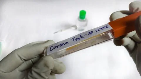 Corona Virus testing kit in hands on lab table Stock Photos
