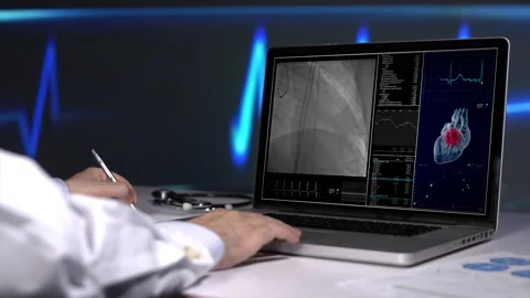 Coronary Angiography  Stock Footage 194879599