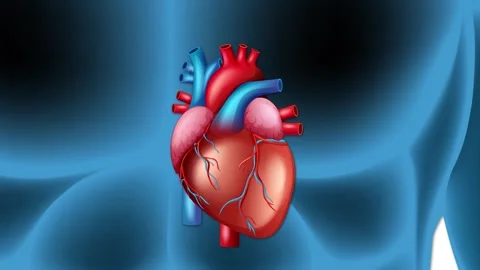 Coronary artery disease explained with a beating heart and close up of bloc.. Stock Footage 333496018