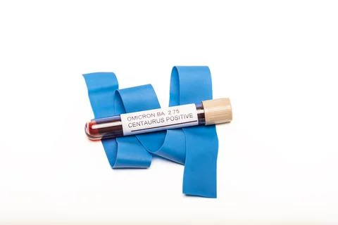 Coronavirus 2019-nCoV variant CENTAURUS BA.2.75 Blood Sample. New Epidemic Stock Photos