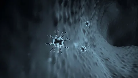 Coronavirus atack the lungs cell, virus attack the human body Stock Footage 75617862