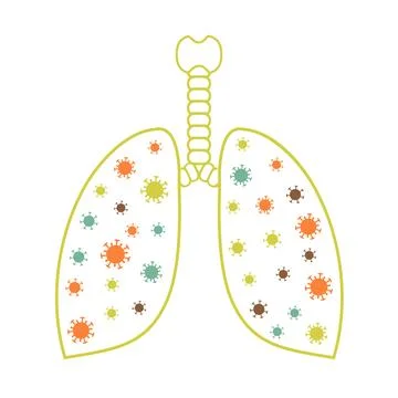 Coronavirus attacks human lungs and causes pneumonia. Lung infection - covid-19 Illustrazione stock