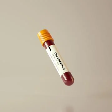 Coronavirus blood sample test tube with light background. Stock Illustration