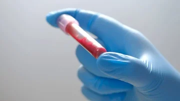 Coronavirus blood test Stock Footage 85476292