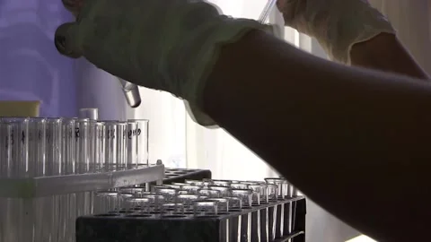 Coronavirus blood test Stock Footage 114008779