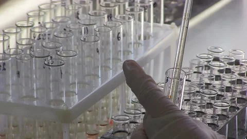 Coronavirus blood test Stock Footage 114008783
