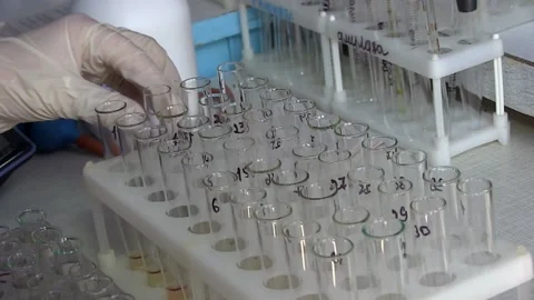 Coronavirus blood test Stock Footage 114008798
