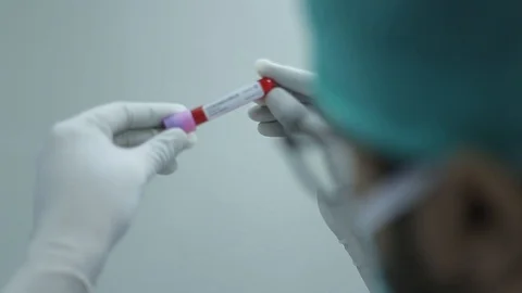 Coronavirus Covid-19 Blood Sample - Corona virus outbreaking Stock Footage 126250020
