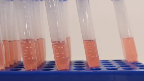 Coronavirus COVID-19 Lab Testing Serum for Swab Nasopharyngeal Testing Stock-Footage 127794361
