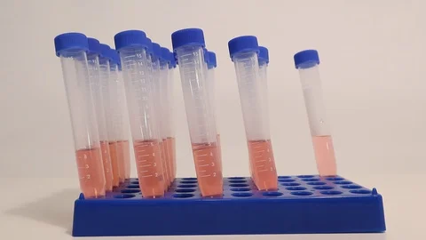 Coronavirus COVID-19 Lab Testing Serum for Swab Nasopharyngeal Testing Video stock 127794417