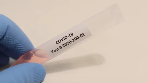 Coronavirus COVID-19 Nurse Rapid Test Swab Results for Positive Negative Stock Footage