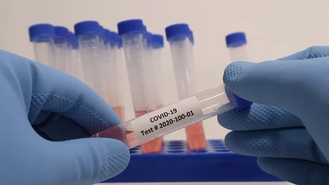 Coronavirus COVID-19 Nurse Testing Swab Results for Positive Negative Test Video stock 127794380