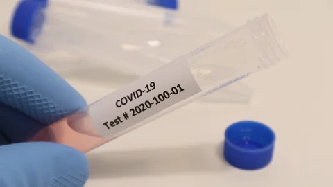 Coronavirus COVID-19 Nurse Testing Swab Results for Positive Negative Test Stock Footage