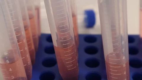 Coronavirus COVID-19 Rapid Test Pink Serum for Swab Nasopharyngeal Testing Stock Footage 127794574