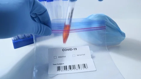 Coronavirus COVID-19 Rapid Test Swab Positive Negative 動画素材 128155751