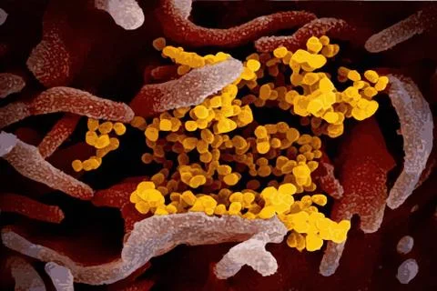 Coronavirus (COVID-19) Real image from Electron Microscope Stock Illustration